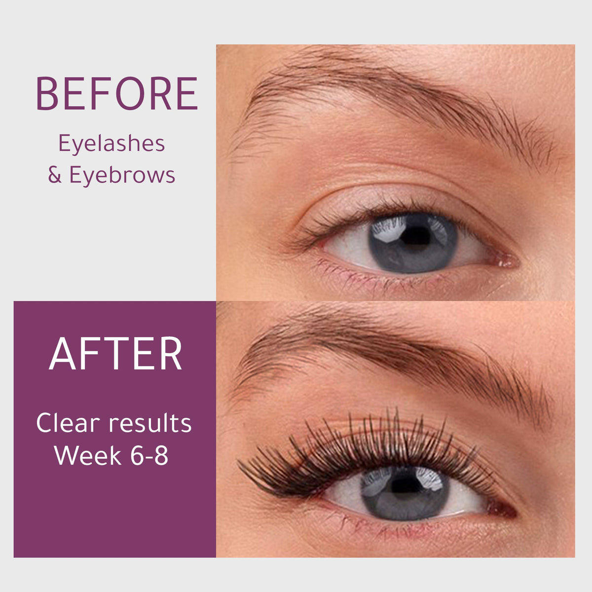 Denefis® Eyebrow & Eyelash Nourishing Care