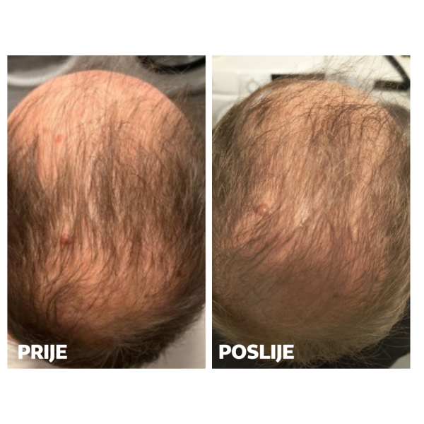 Skinage HAIR Strong MEN 60s Capsules